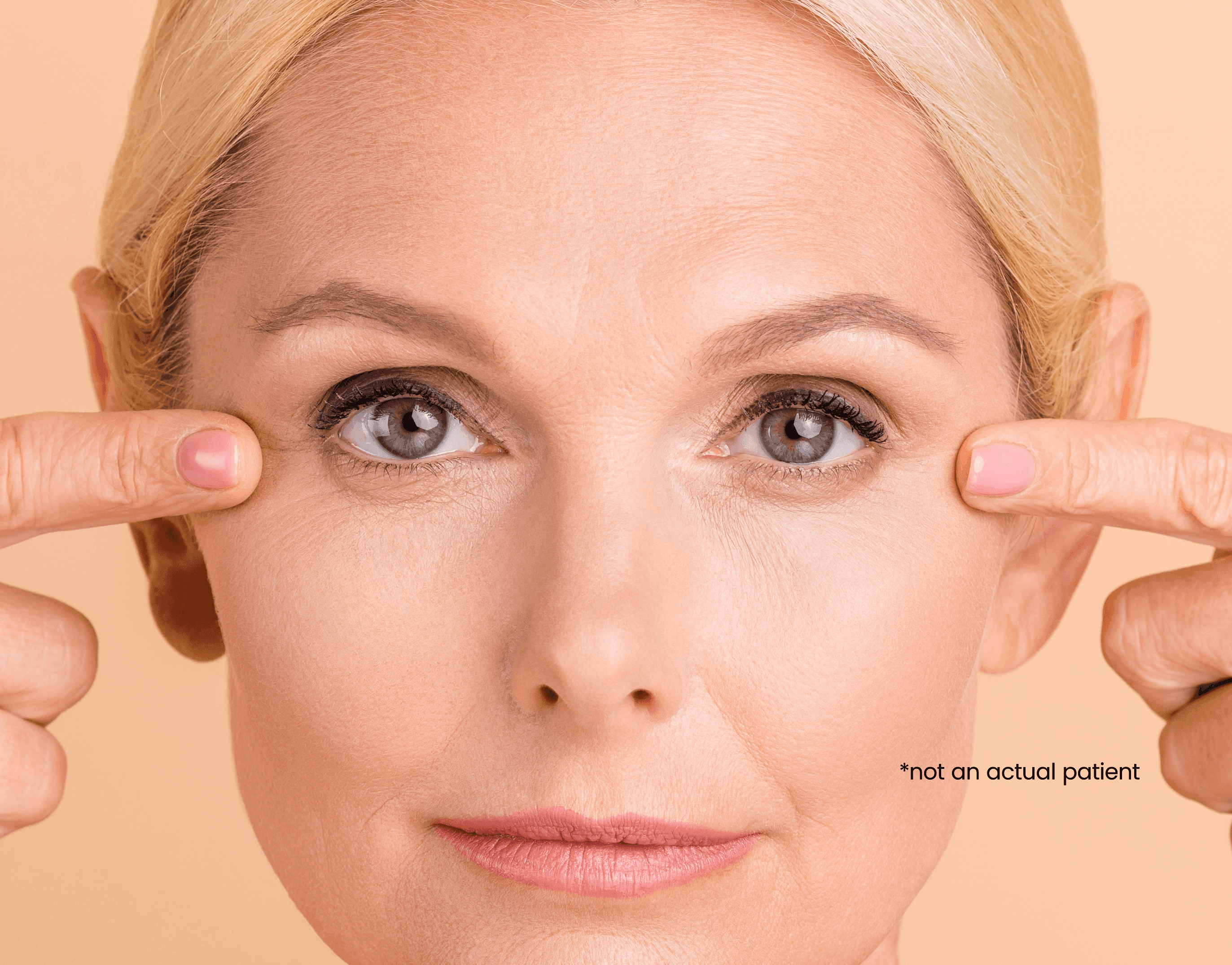 Ptosis Prevention: Understanding and Preventing Acquired Ptosis cover image