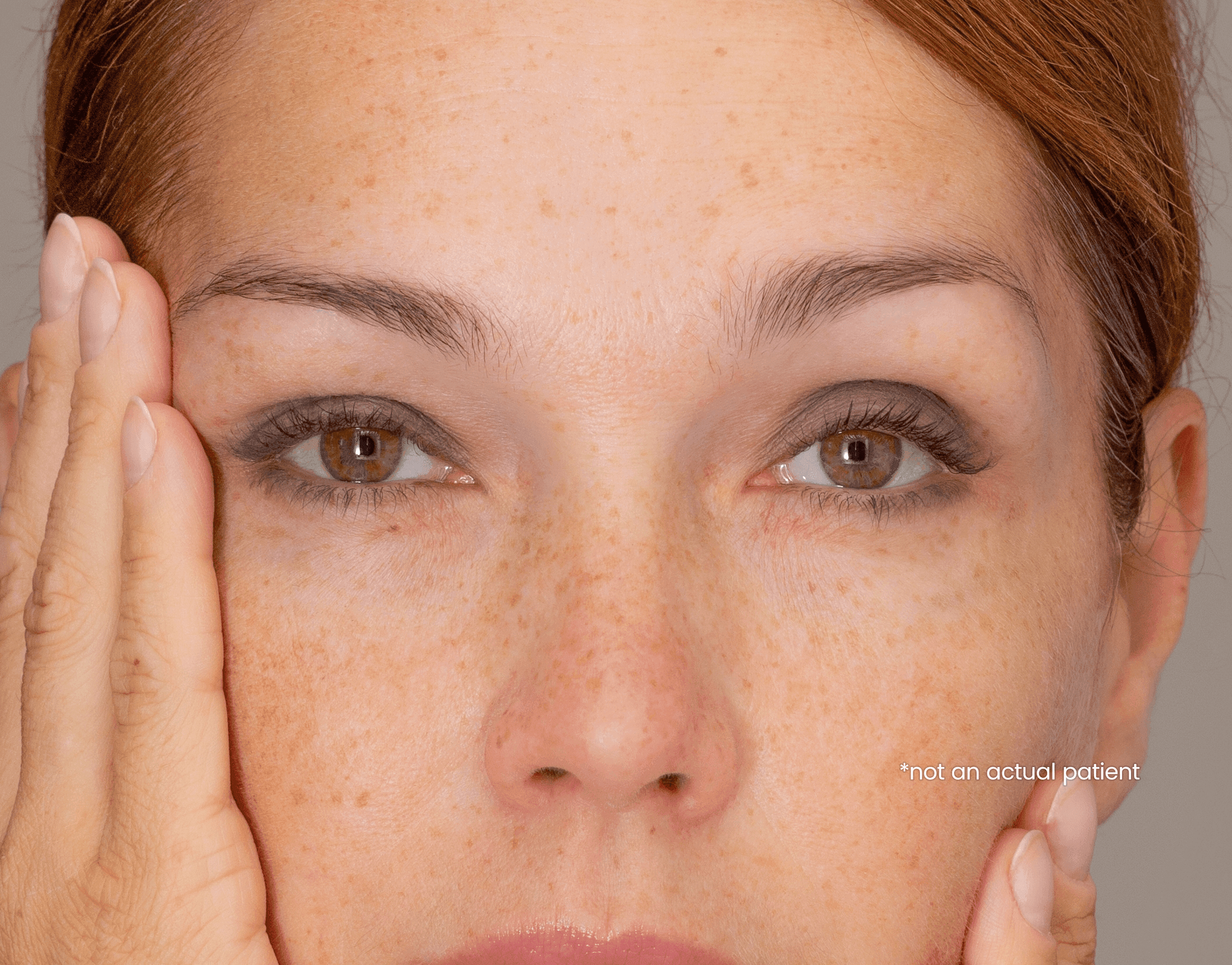 Ptosis Symptoms: Understanding Signs of Acquired Ptosis cover image