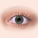 normal-eye